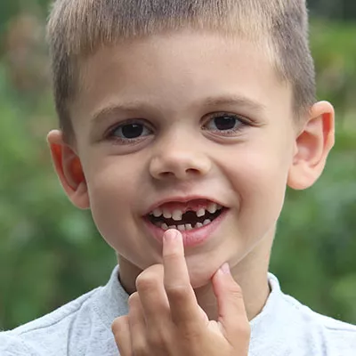 Young boy with missing tooth